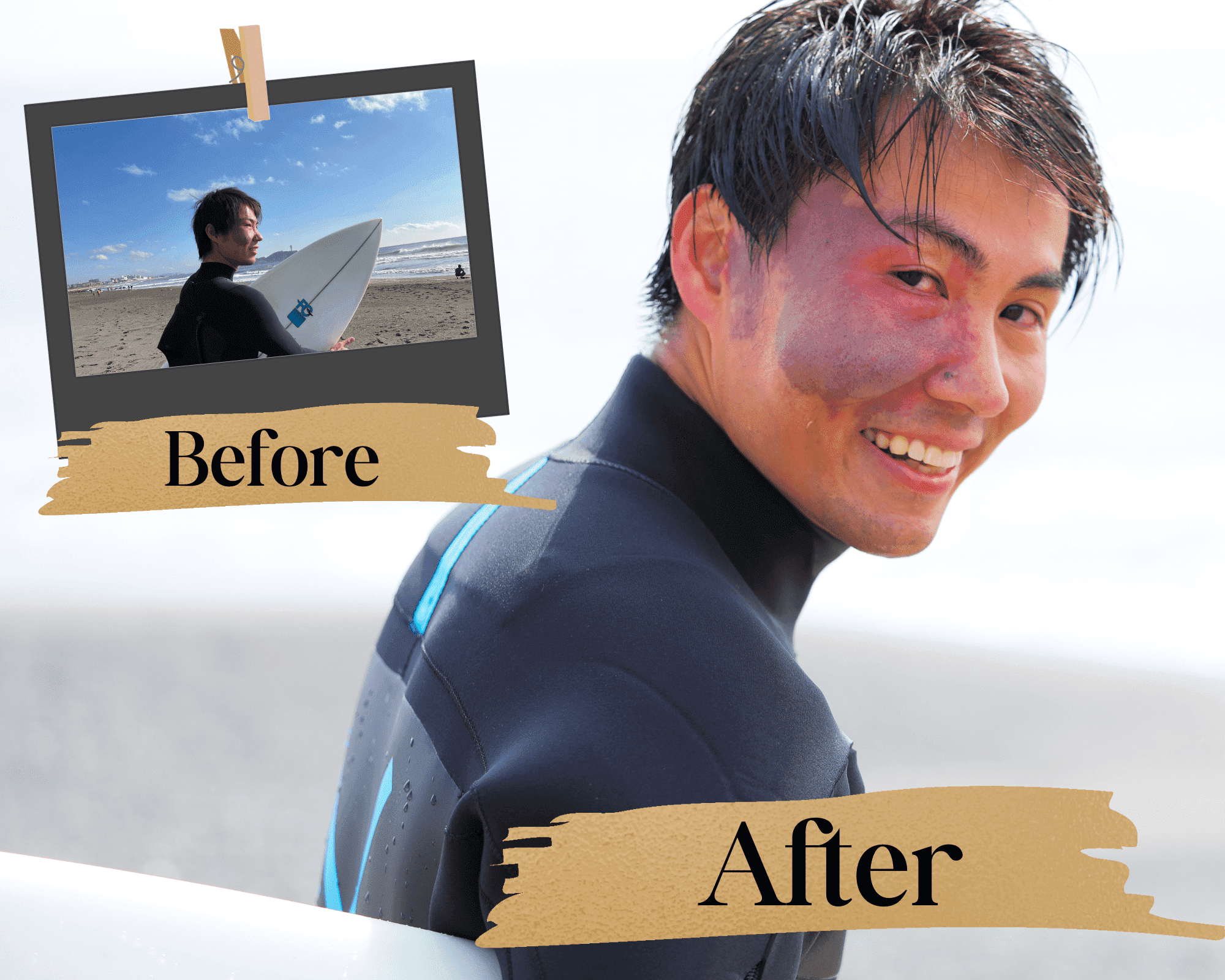 before after画像3